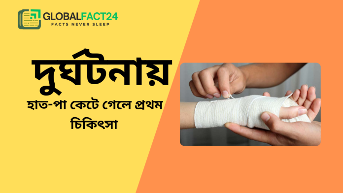 দুর্ঘটনায় হাত-পা কেটে গেলে প্রথম চিকিৎসা